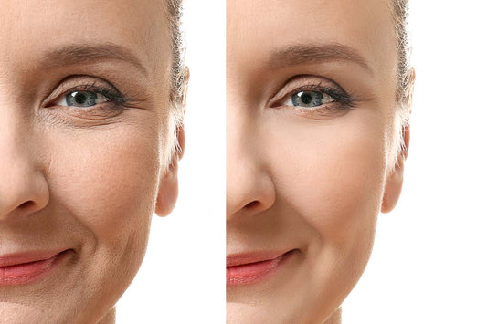 Domeli'C Facial Hair Removal : Natural and permanent Solution for Smooth Skin