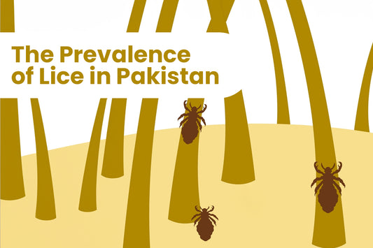 Close-up image of a comb removing lice and nits from a strand of healthy hair, symbolizing the importance of regular lice checks for maintaining scalp and hair health.