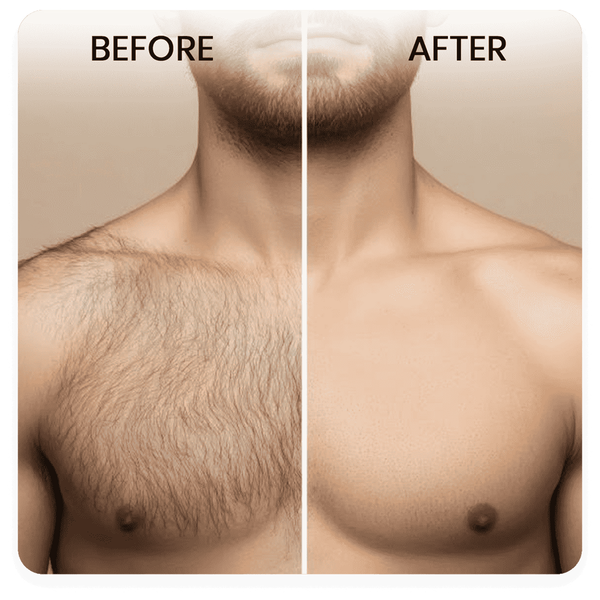 DomeliC Natural Hair Inhibitor - Permanent Hair Removal Spray