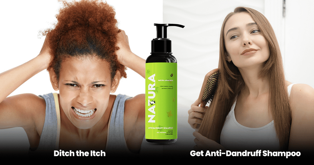 Frustrated woman itching scalp and satisfied user with Natura anti-dandruff shampoo.
